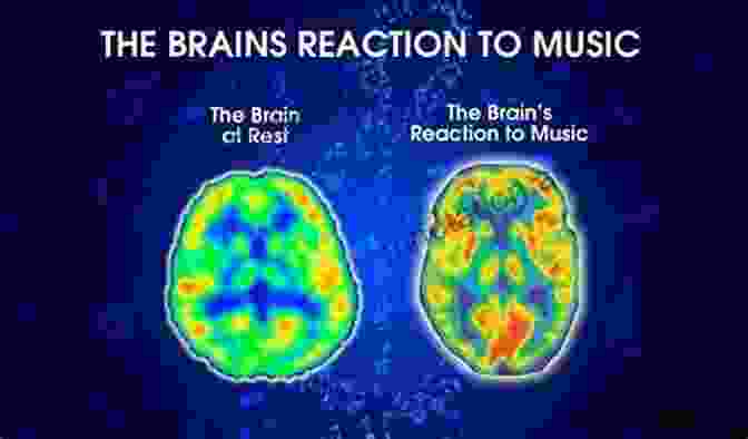 Brain Scan Showing Activity When Listening To Music How Music Works David Byrne