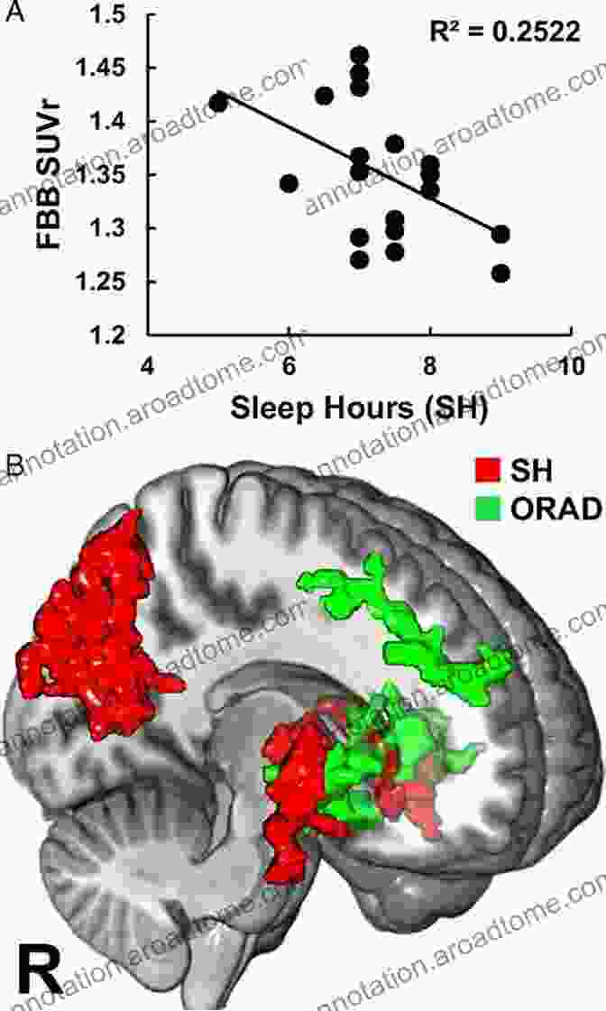 Brain Scan Showing Increased Amyloid Beta Plaques In Sleep Deprived Individuals Why We Don T Sleep: How The Wellness Industry Unintentionally Created An Insomnia Epidemic