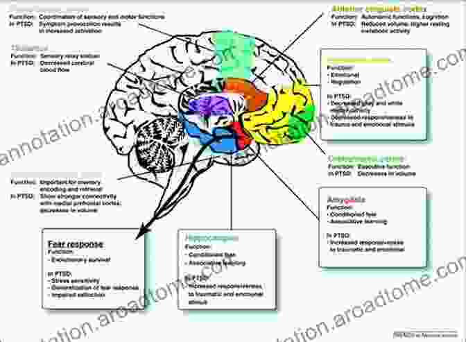 Diagram Illustrating The Brain Regions Involved In Anxiety, Depression, And Trauma Lasting Change: Overcoming The Grip Of Anxiety Depression Trauma With User Friendly Neuroscience