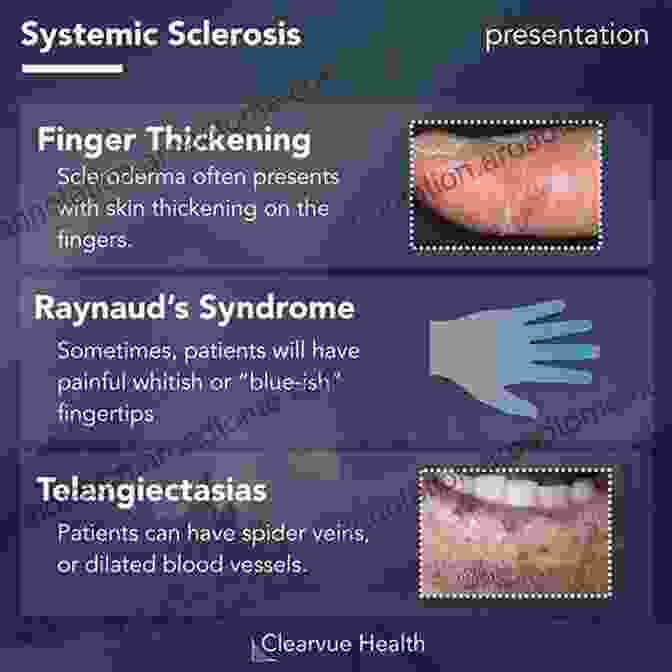 Early Signs And Symptoms Of Systemic Disease Clinical Pathology For Athletic Trainers: Recognizing Systemic Disease Third Edition (Recognizing Systematic Disease)