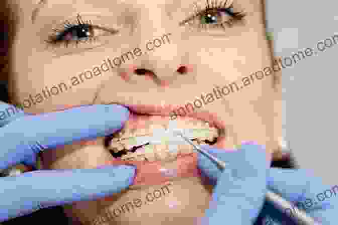 Orthodontist Adjusting Braces On A Patient's Teeth Orthodontics At A Glance (At A Glance (Dentistry))