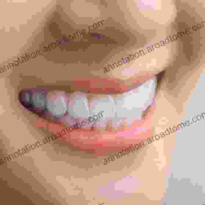 Patient Wearing Clear Aligners Orthodontics At A Glance (At A Glance (Dentistry))