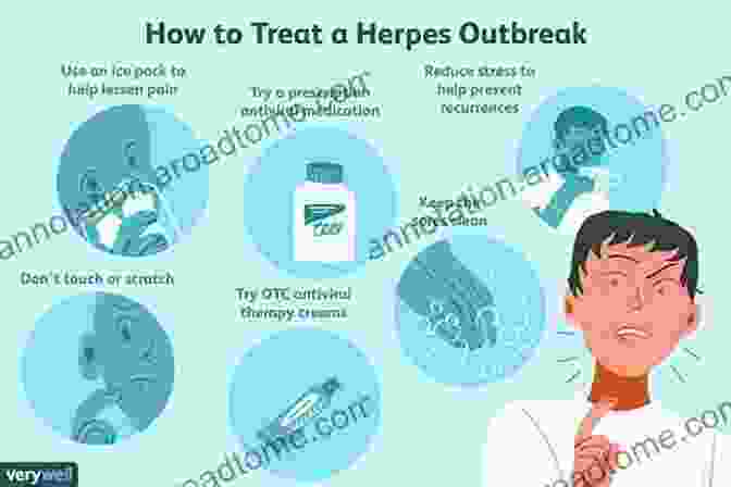 Treatment Options For Herpes HSV2 Herpes (HSV2) : What Doctors Won T Tell You