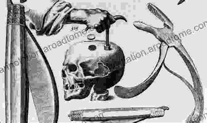 Trephination, An Ancient Surgical Procedure Used To Treat Mental Illness A History Of Insanity Darryl Mars