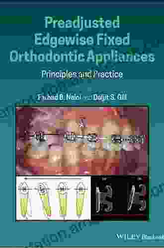 Preadjusted Edgewise Fixed Orthodontic Appliances: Principles And Practice