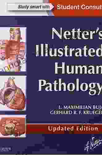 Netter S Illustrated Human Pathology Updated Edition E Book: With Student Consult Access